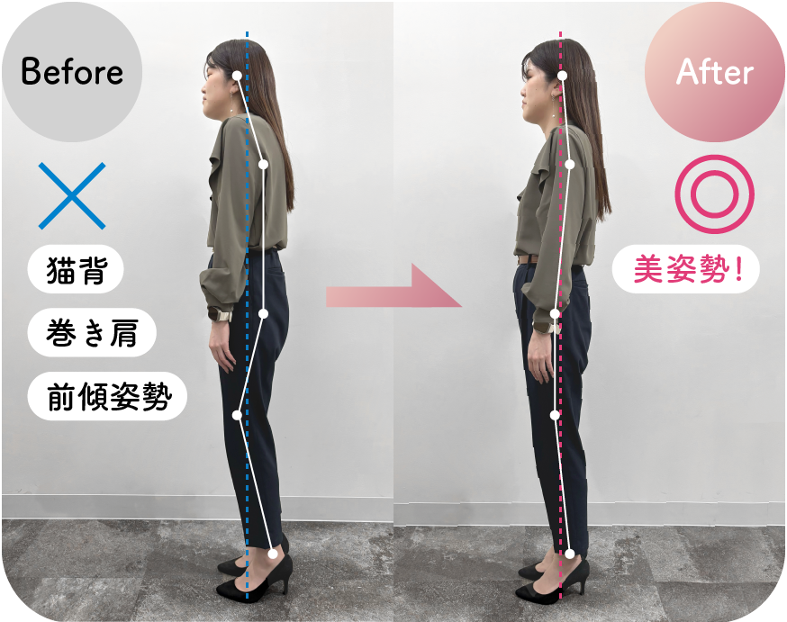 美姿勢サポート Before/After